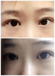 -YooMee优美智能科技美肤机构
