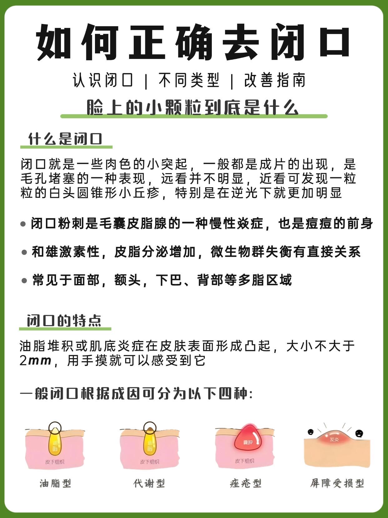 长闭口的正确消除方法图片