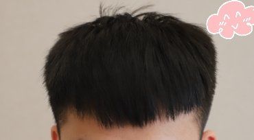 -大麦微针植发丨全国连锁