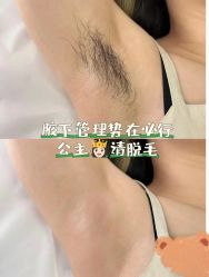 -薇兰专业脱毛连锁机构