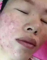 -痘院士祛痘美容皮肤管理