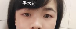 -广州美莱医疗美容医院
