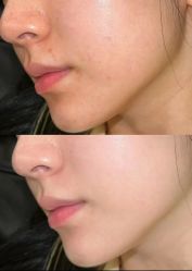 -深圳米兰柏羽医疗美容医院