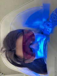 -OKIRE牙齿美白SPA