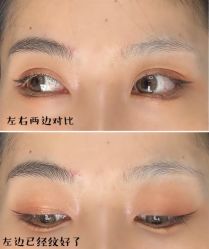 -莲姿娜·半永久纹眉皮肤管理