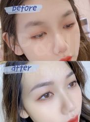 -UP&UP·半永久眉毛眼线机器野生眉