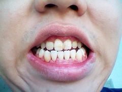 -天津市第三中心医院