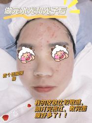 体验后-上海首尔丽格医疗美容医院
