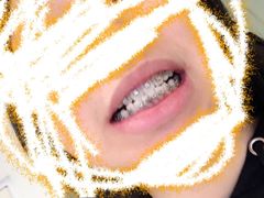 -柏乐口腔(南宁总院)
