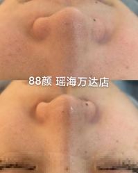 -Cream88颜皮肤管理中心