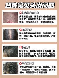 -Bollins波林丝•专研护发中心