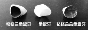 -团圆口腔·种植中心(锦江院区)