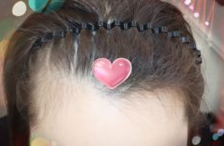 -大麦微针植发全国连锁