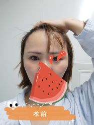 点击看大图 体验后-上海首尔丽格医疗美容医院