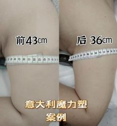 -Lily纤美·科技减脂中心