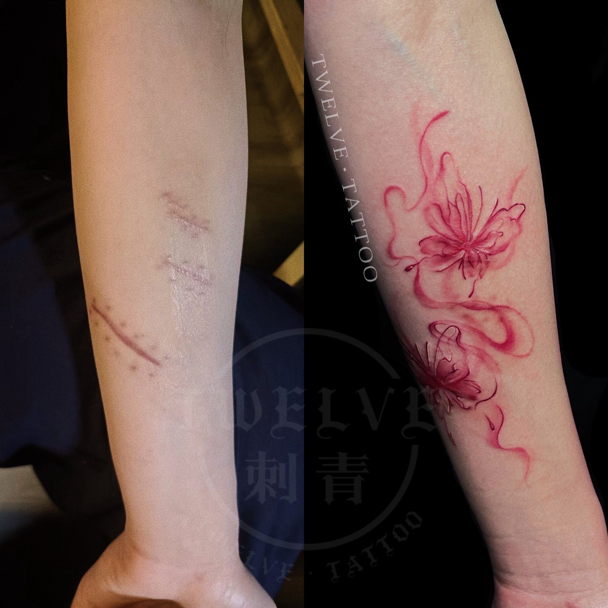 蝴蝶纹身遮盖伤疤