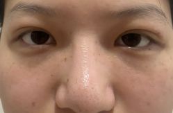 -长沙雅美医疗美容医院