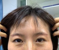 -八大处整形