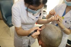 点击看大图 -大麦微针植发丨全国连锁