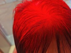 -碧莲盛·不剃发植发