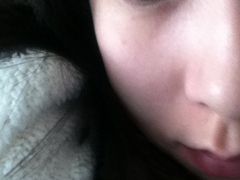 原来贴双眼皮贴的眼睛-上海华安整形外科门诊部