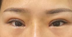 体验后-天津伊美尔医疗整形美容专科医院