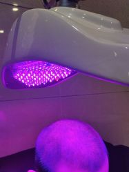 -碧莲盛·不剃发植发