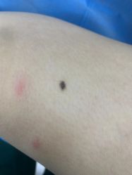 -丽美妍医疗美容·皮秒·立体分层抗衰