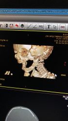 -浙江大学医学院附属儿童医院(湖滨院区)