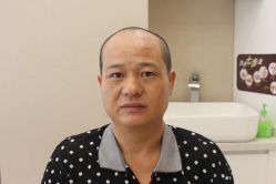 -大麦微针植发丨全国连锁
