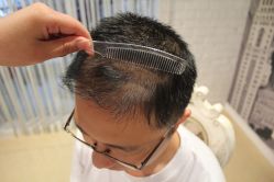 -大麦微针植发丨全国连锁