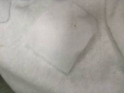 点击看大图 -痘博士广州·全国连锁祛痘机构