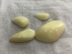 大蒜-郑记biangbiang面(钟楼店)