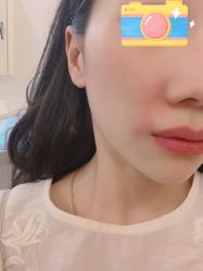 -新美荟医美·专注面部美学抗衰
