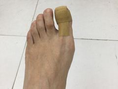 -新甲连锁灰指甲·甲沟炎·鸡眼(黑龙江路店)