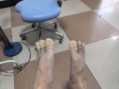 -世龙世家灰指甲鸡眼脚气甲沟炎跖疣护理(通州店)