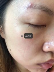 -美愈美肤MEIYU SKIN