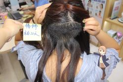 -大麦微针植发丨全国连锁