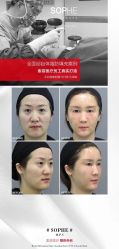-索菲医疗整形美容