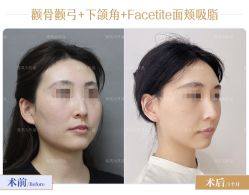 -圣嘉新医疗美容医院