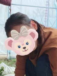 体验后-熙朵美学植发·连锁品牌