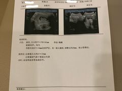 -西安曲江妇产医院-妇科