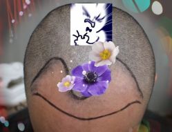 -大麦微针植发全国连锁