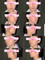 -海菲秀·飞顿牛奶光·LDM官方授权中心美轮美浣瓷感美肌