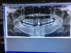 -佛山中大口腔医院·市二级口腔专科医院