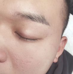做完太自然了-杨丹国际美学肌研所