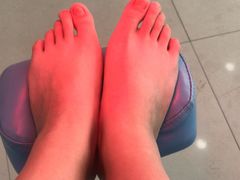 -派恩宜灰指甲(勤业店)