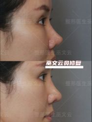 -北京米扬丽格医疗美容·联合丽格鼻整形中心