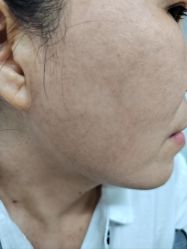 -广州美莱医疗美容医院