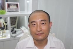 -大麦微针植发丨全国连锁